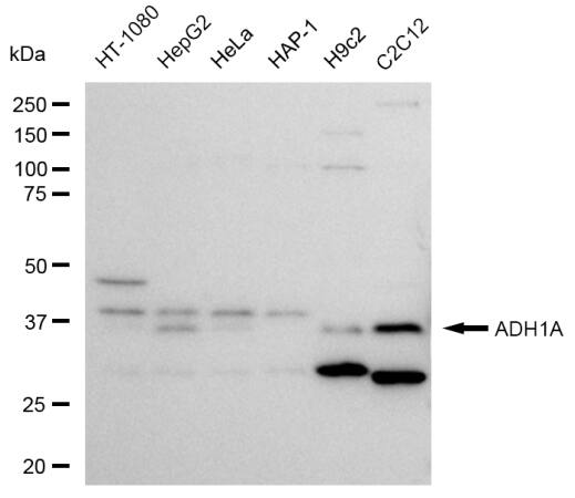 alcohol dehydrogenase 1A Antibody (23GB4295)