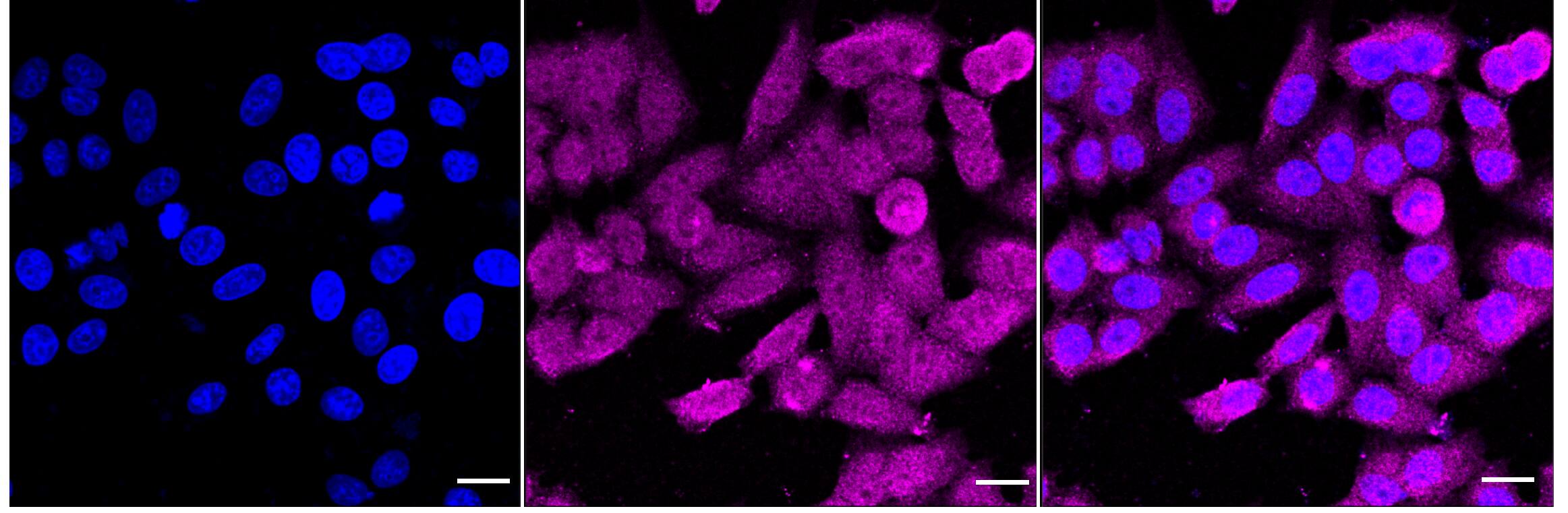 ALDH16A1 Antibody (23GB4315)