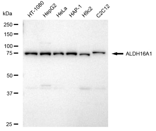 ALDH16A1 Antibody (23GB4315)