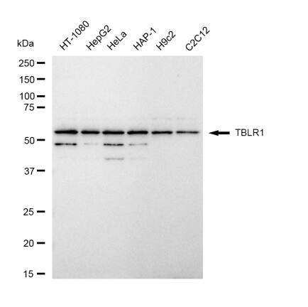 TBLR1 Antibody (23GB4935)