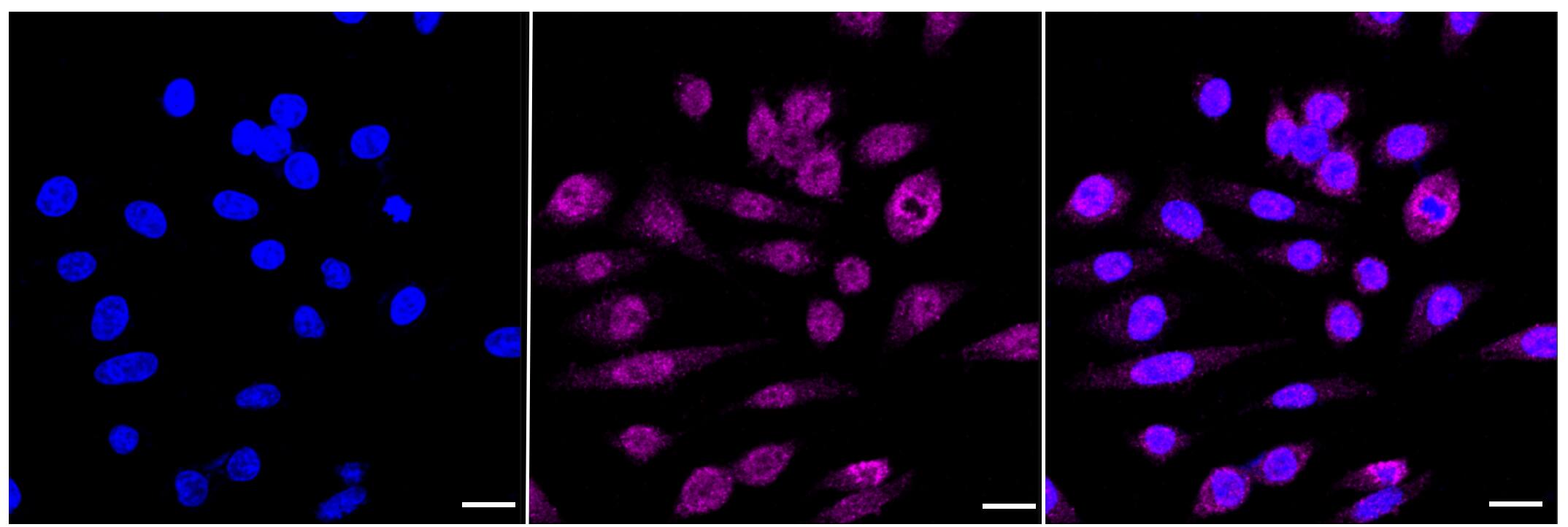 Wnt-2b Antibody (23GB4930)