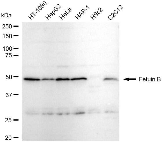 Fetuin B Antibody (23GB5725)