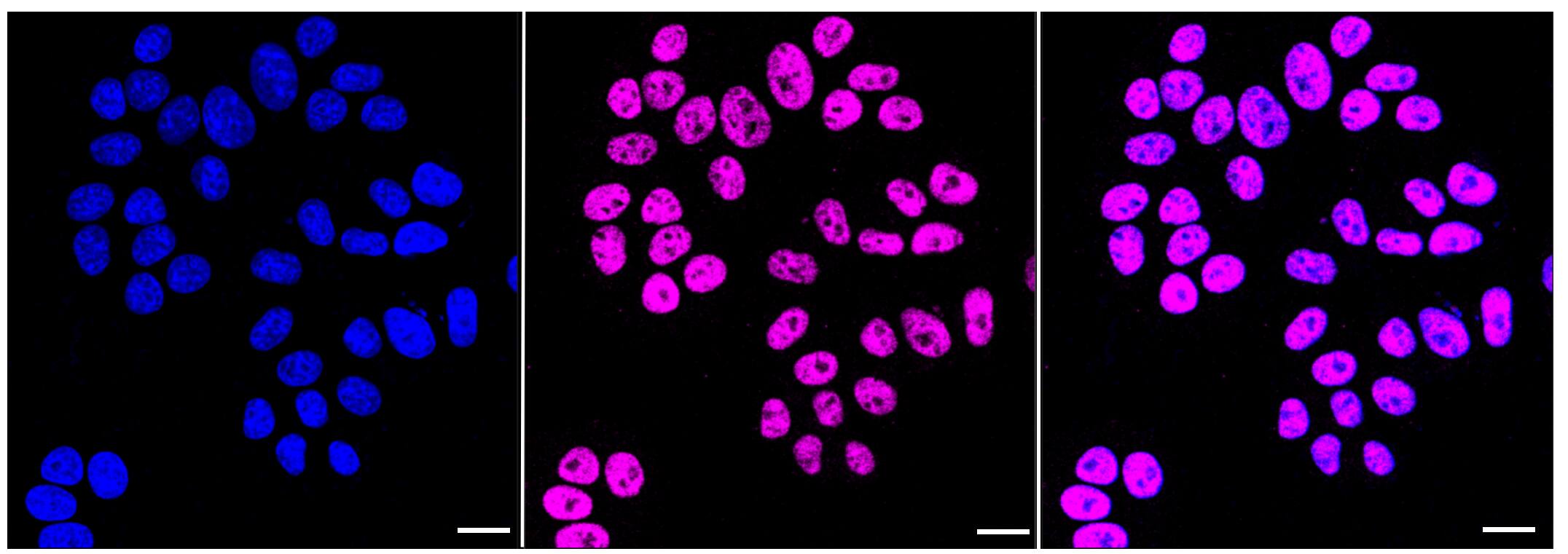 Histone H2B type 2E [Formyl Lys120] Antibody (23GB5945)