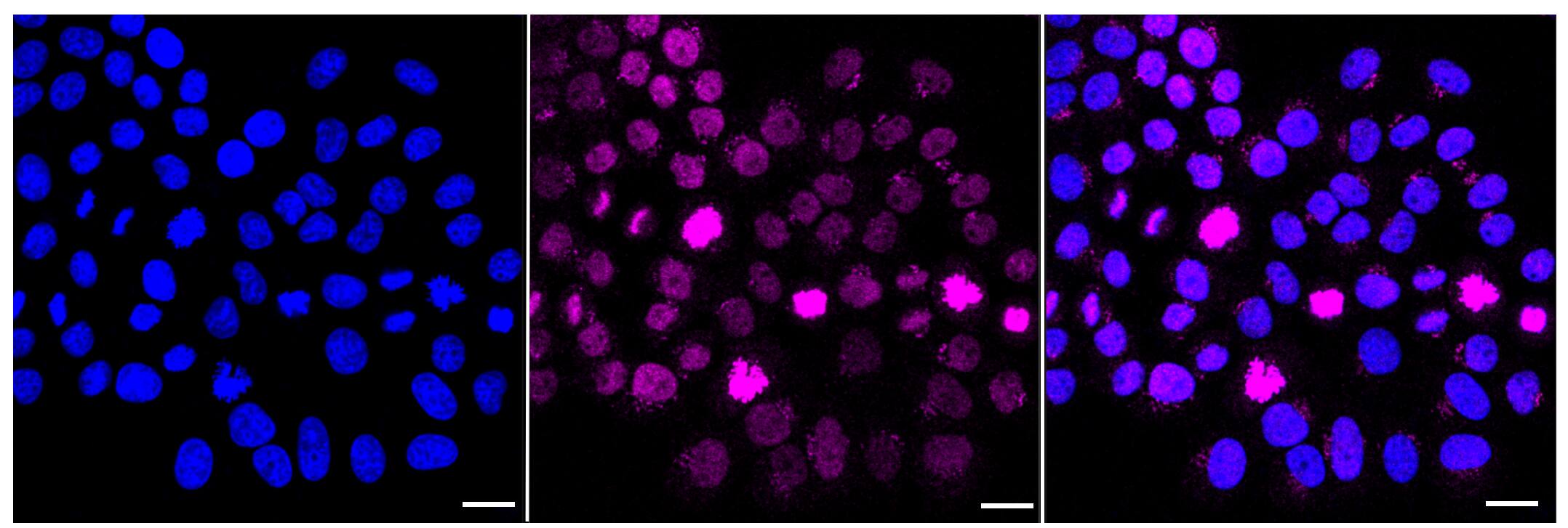 Histone H3.3 [p Ser31] Antibody (23GB6015)