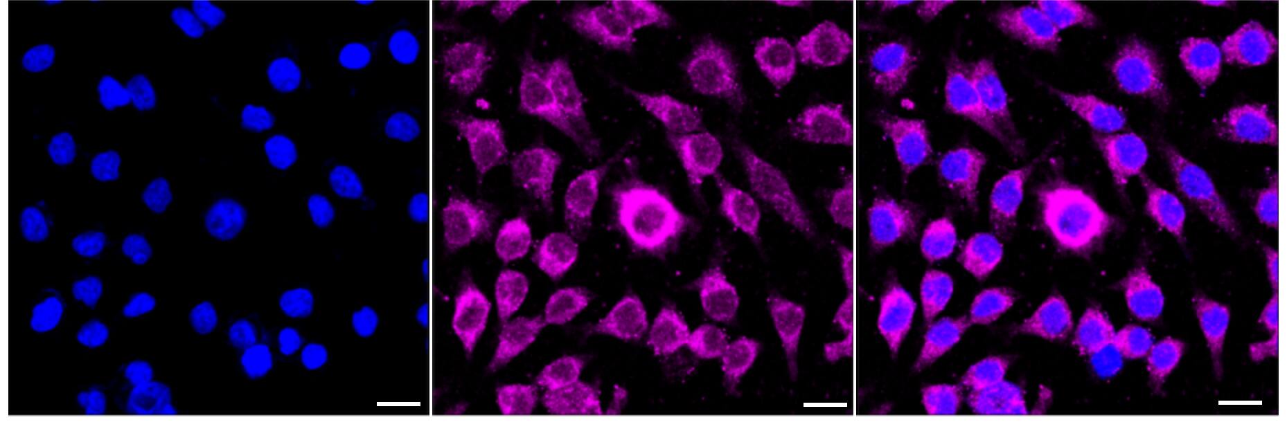 ROCK1 Antibody (24GB5310)