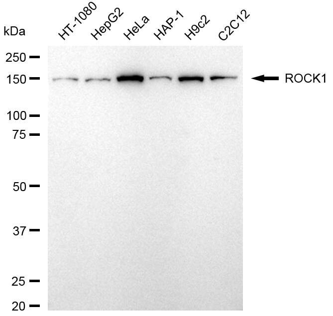 ROCK1 Antibody (24GB5310)