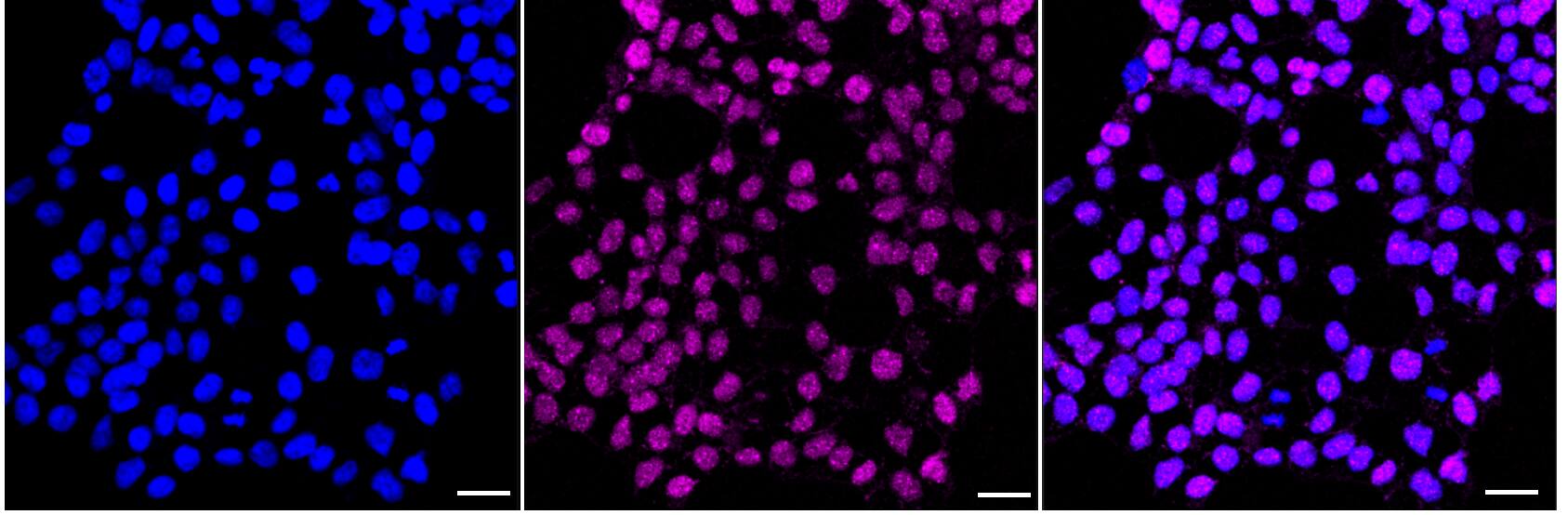 Islet-1 Antibody (23GB6115)