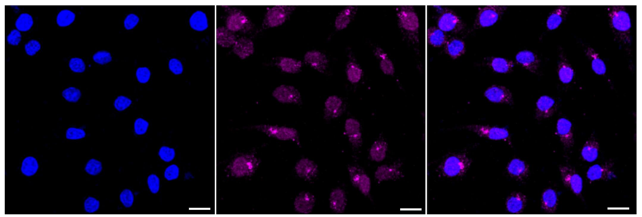 Histone Deacetylase 8/HDAC8 Antibody (23GB6180)