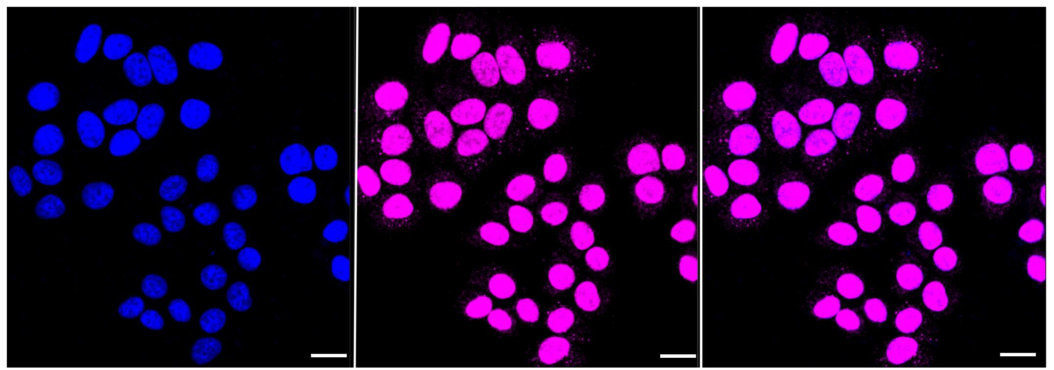 Histone Deacetylase 8/HDAC8 Antibody (23GB6185)