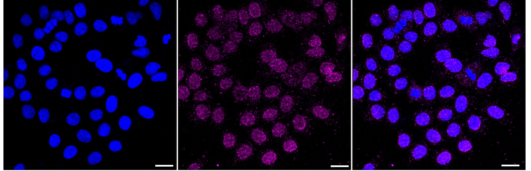Histone H2B type 2E [Crotonyl Lys12] Antibody (23GB6335)
