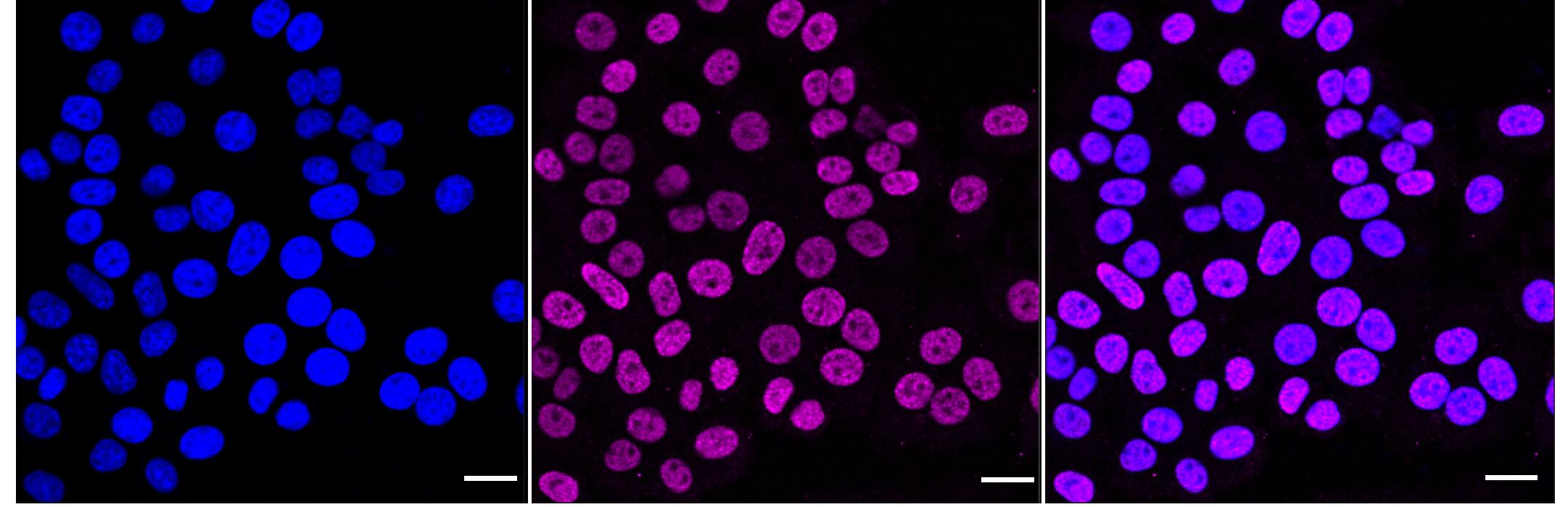 Histone H2B type 2E [ac Lys16] Antibody (23GB6340)