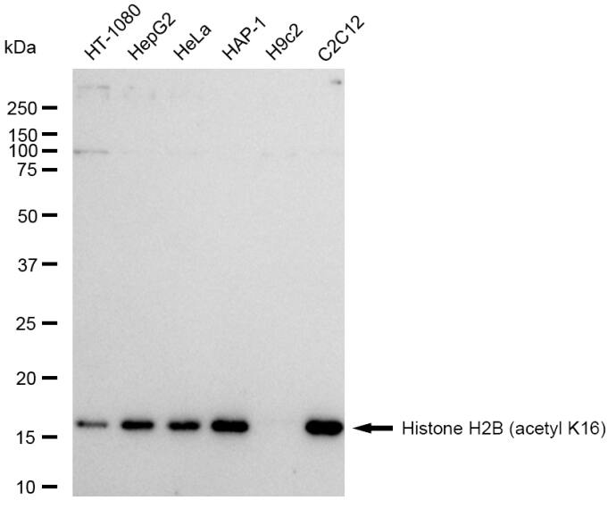 Histone H2B type 2E [ac Lys16] Antibody (23GB6340)