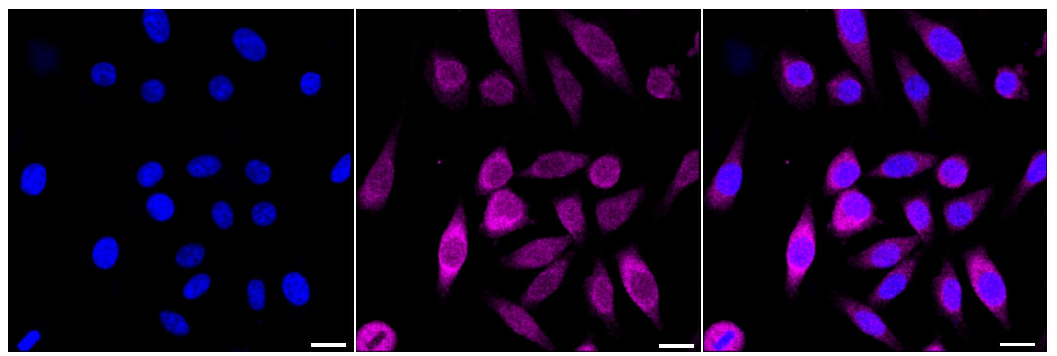 PHD4/HIF Prolyl Hydroxylase 4 Antibody (24GB100)