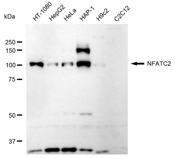 NFATC2/NFAT1 Antibody (24GB360)