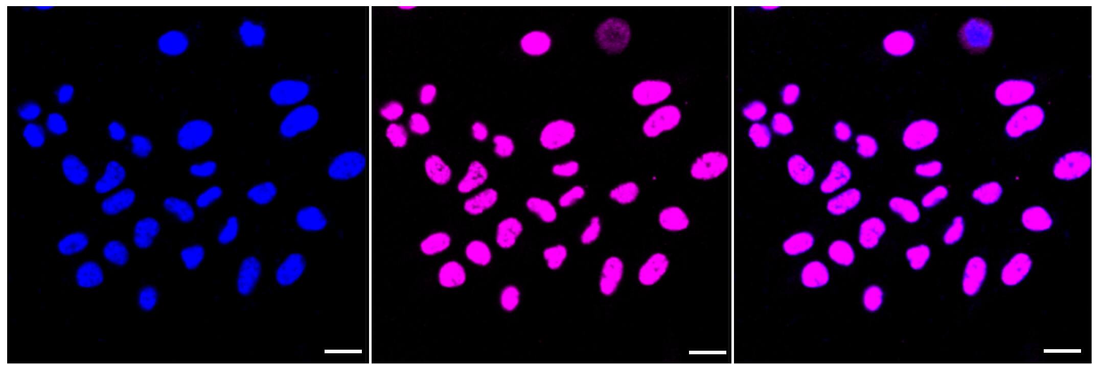 HDAC9 Antibody (23GB2045)