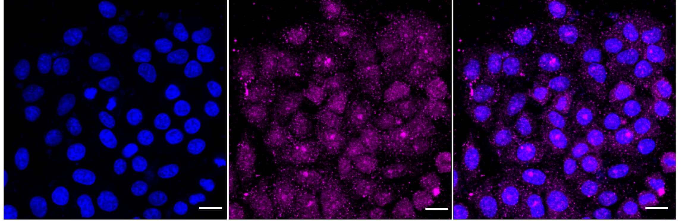 Insulin R/CD220 Antibody (23GB2050)
