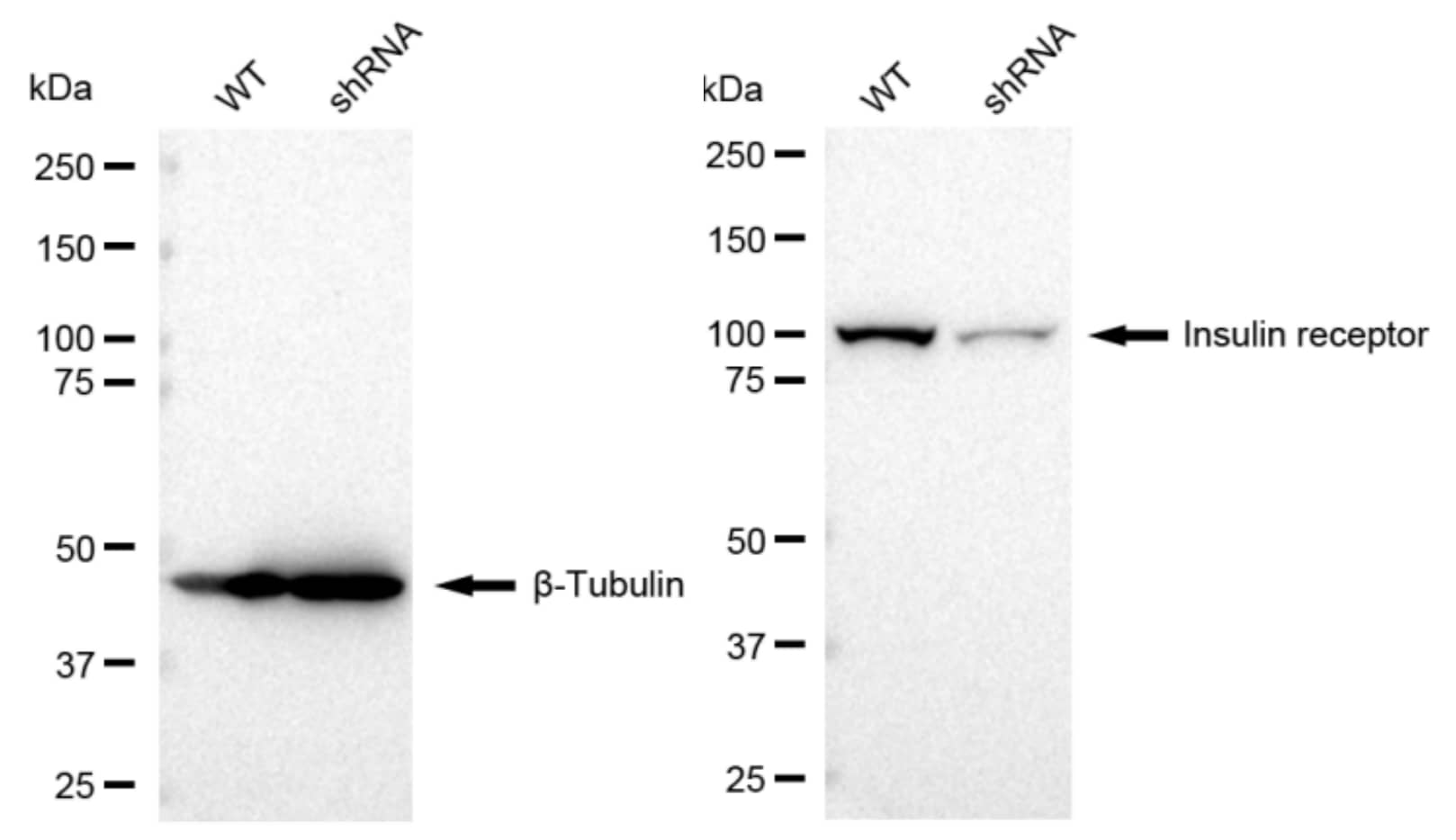 Insulin R/CD220 Antibody (23GB2050)