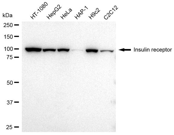 Insulin R/CD220 Antibody (23GB2050)