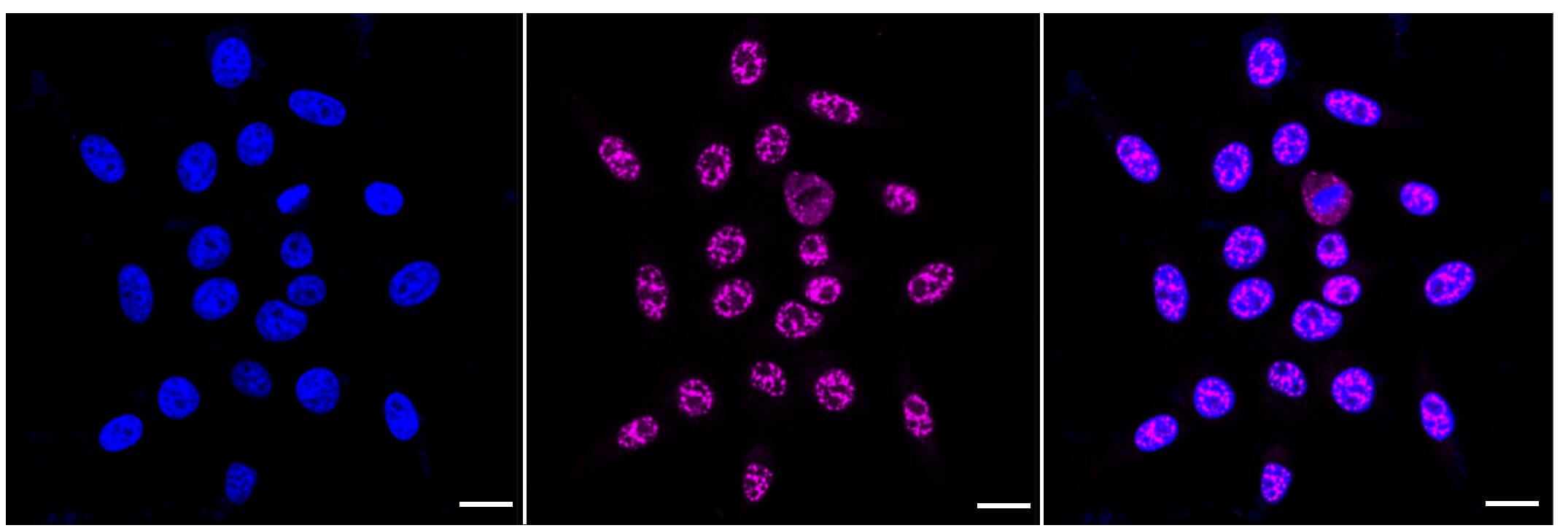 NDUFC2 Antibody (24GB505)