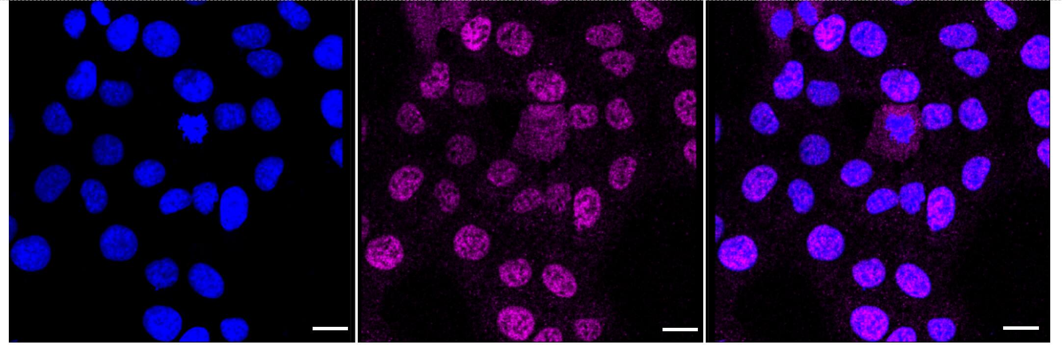 TLX/NR2E1 Antibody (24GB605)