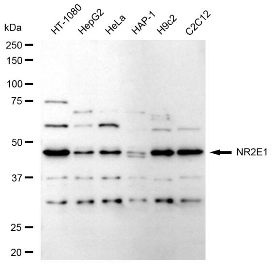 TLX/NR2E1 Antibody (24GB605)
