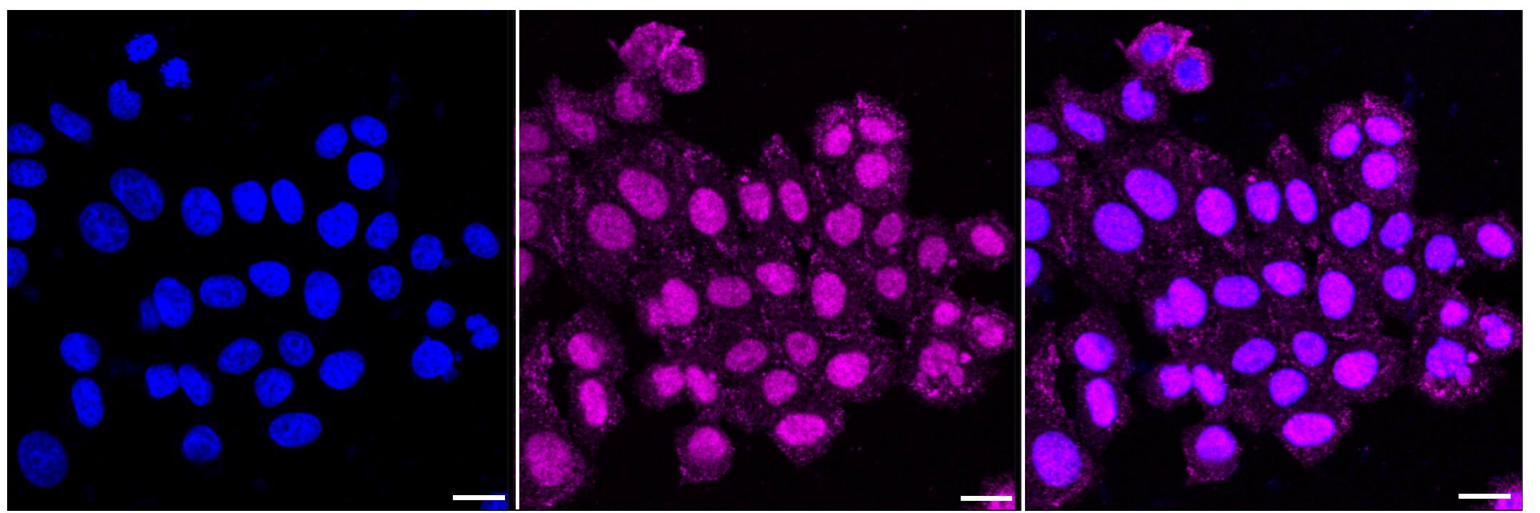 MSP/MST1 Antibody (24GB635)