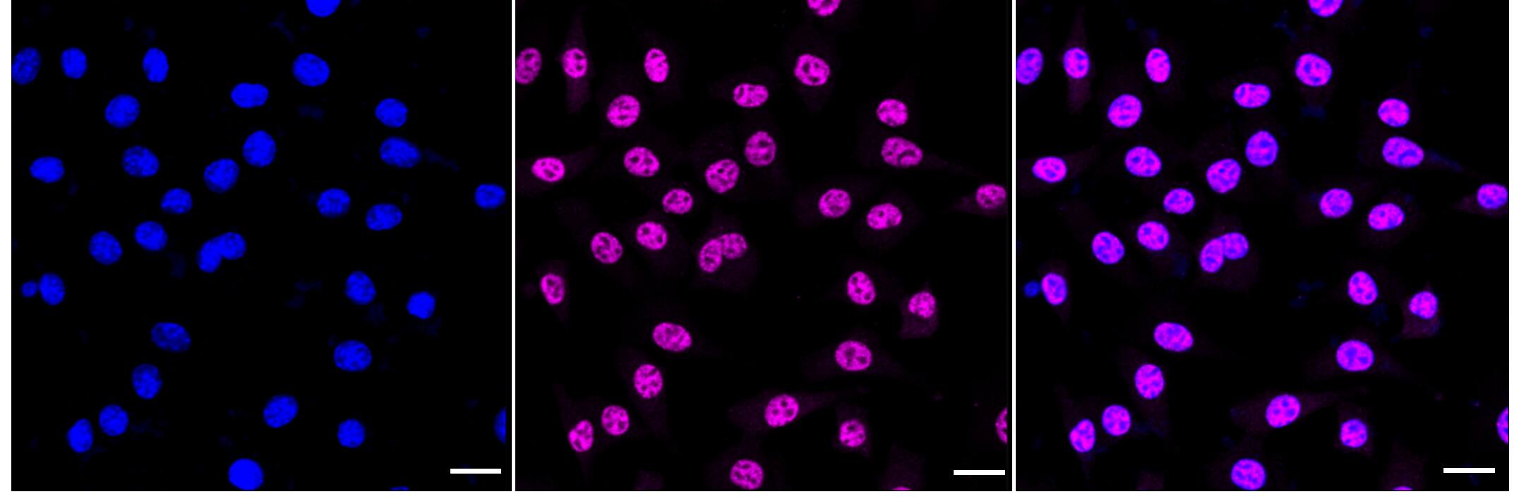 RNA Polymerase II/POLR2A [p Ser5] Antibody (24GB1180)