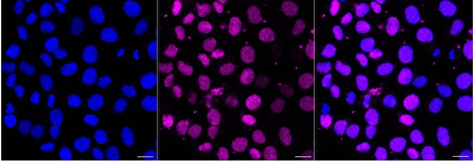 PIM1 Antibody (24GB1410)