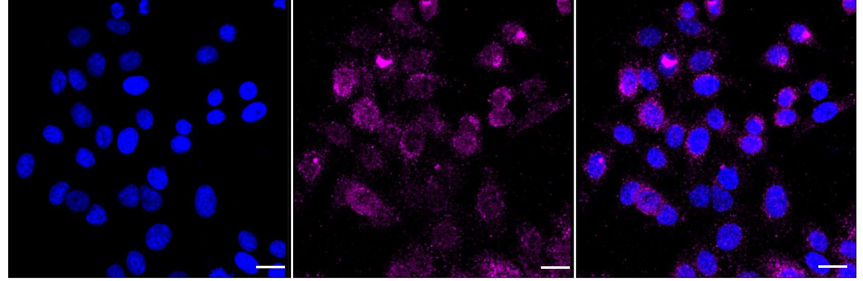 PKC eta Antibody (24GB1480)