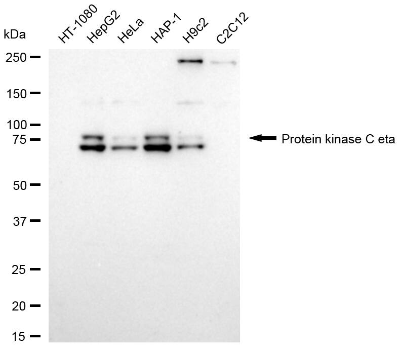 PKC eta Antibody (24GB1480)