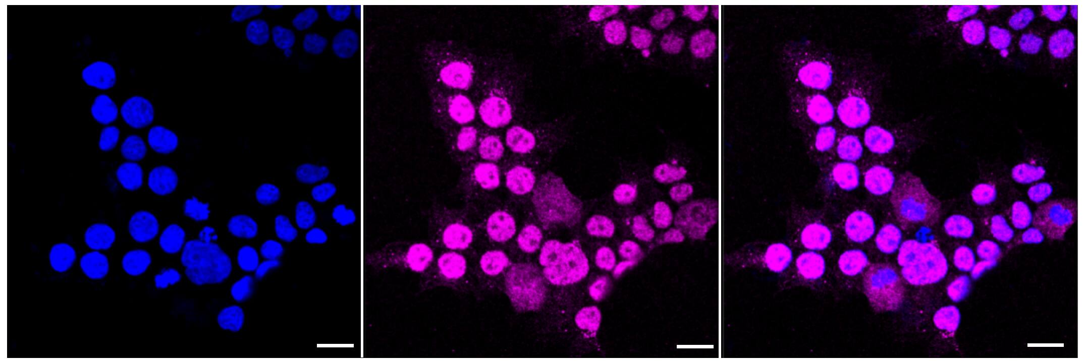 ACBD3 Antibody (23GB3620)