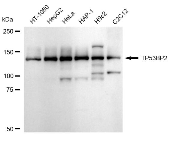53BP2 Antibody (24GB2145)