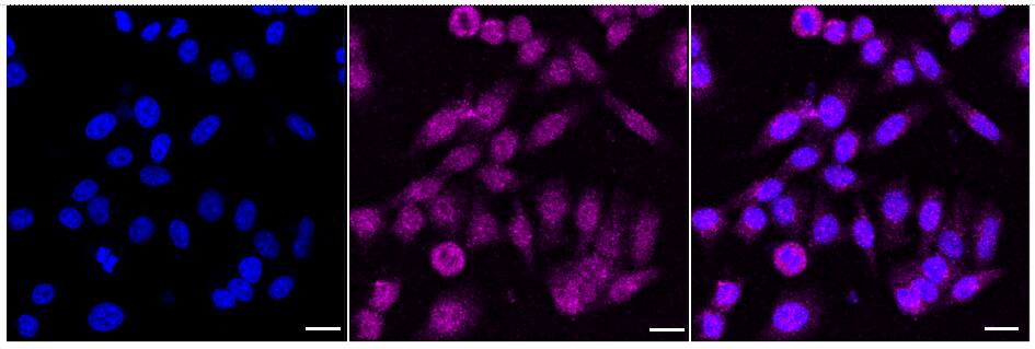 SF2 Antibody (24GB2255)