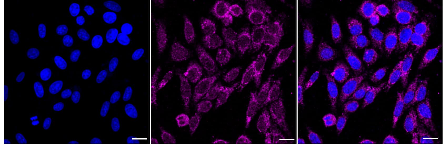 WIPI1 Antibody (24GB2285)