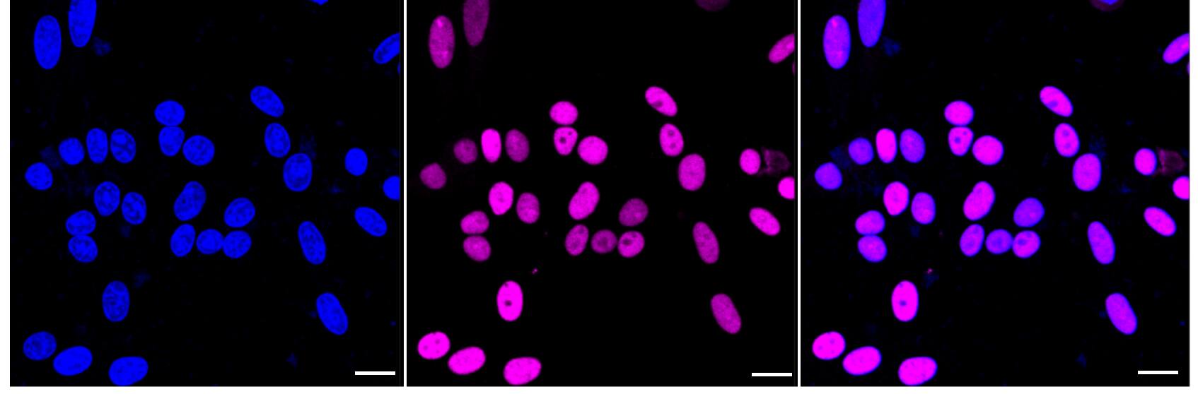 ZBTB7A/Pokemon Antibody (24GB2395)