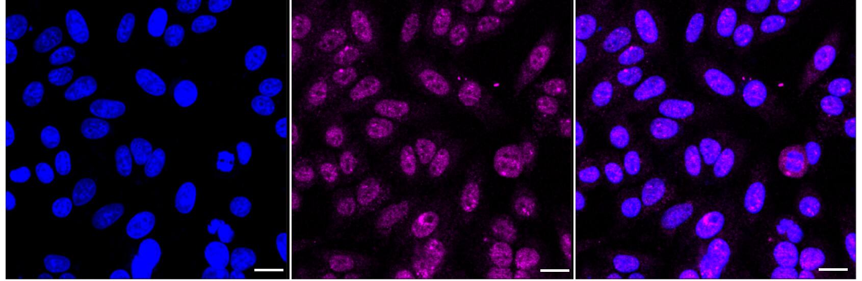 Ubiquitin-activating Enzyme/UBE1 Antibody (24GB2435)