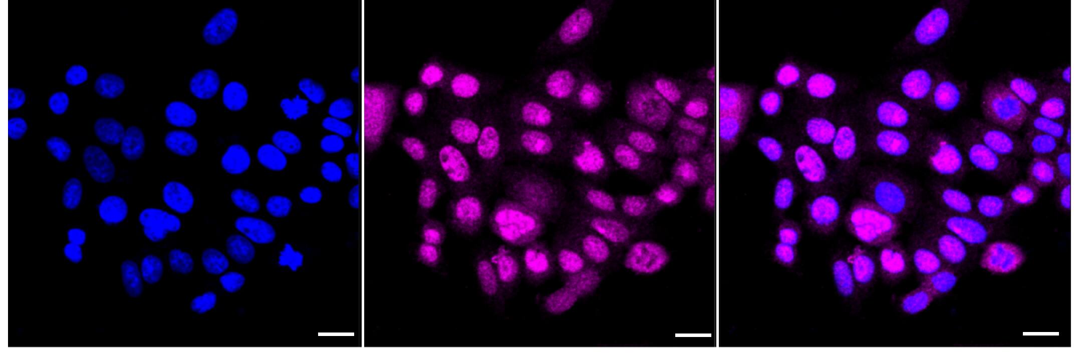 TRPV5 Antibody (24GB1850)