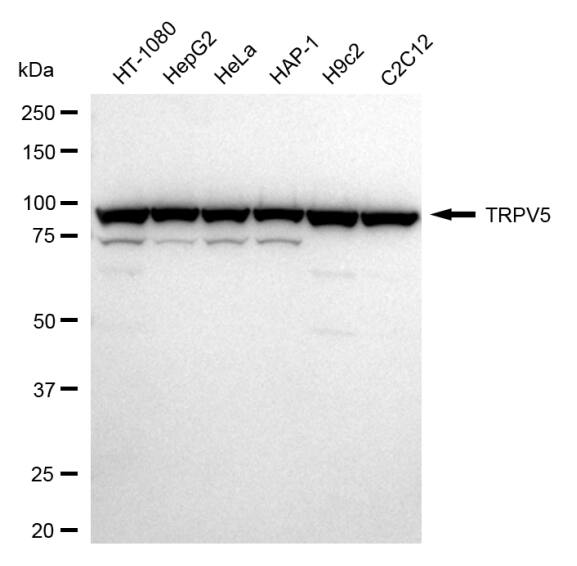 TRPV5 Antibody (24GB1850)