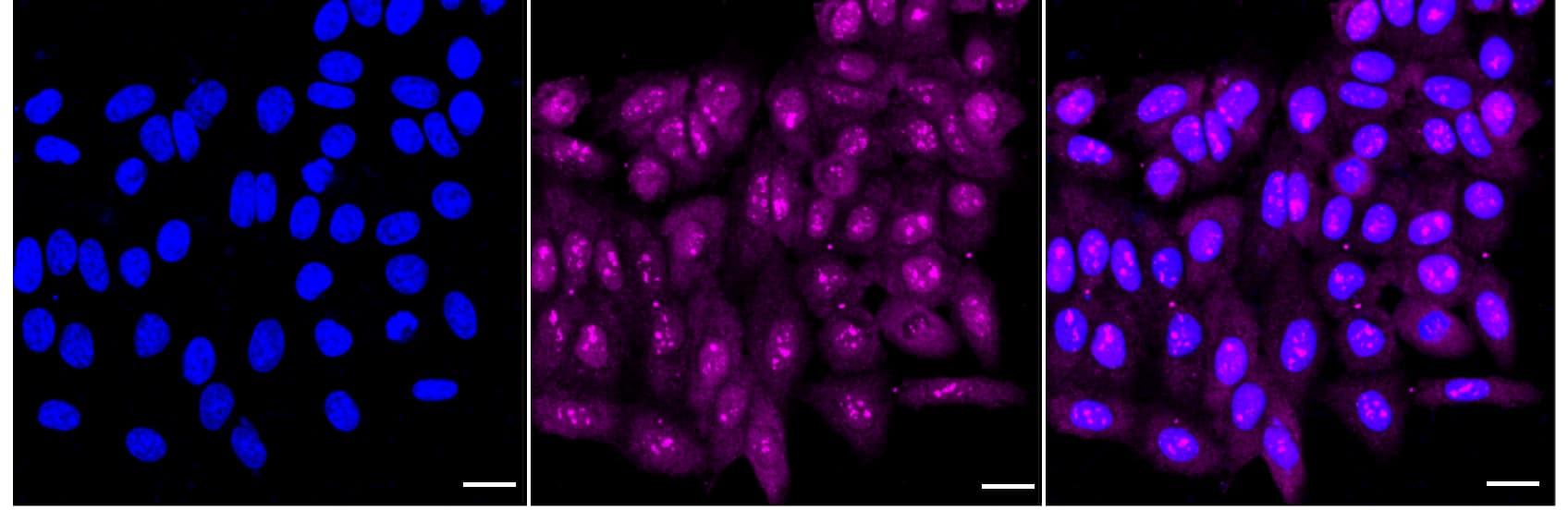 Ubiquitin-activating Enzyme/UBE1 Antibody (24GB2130)