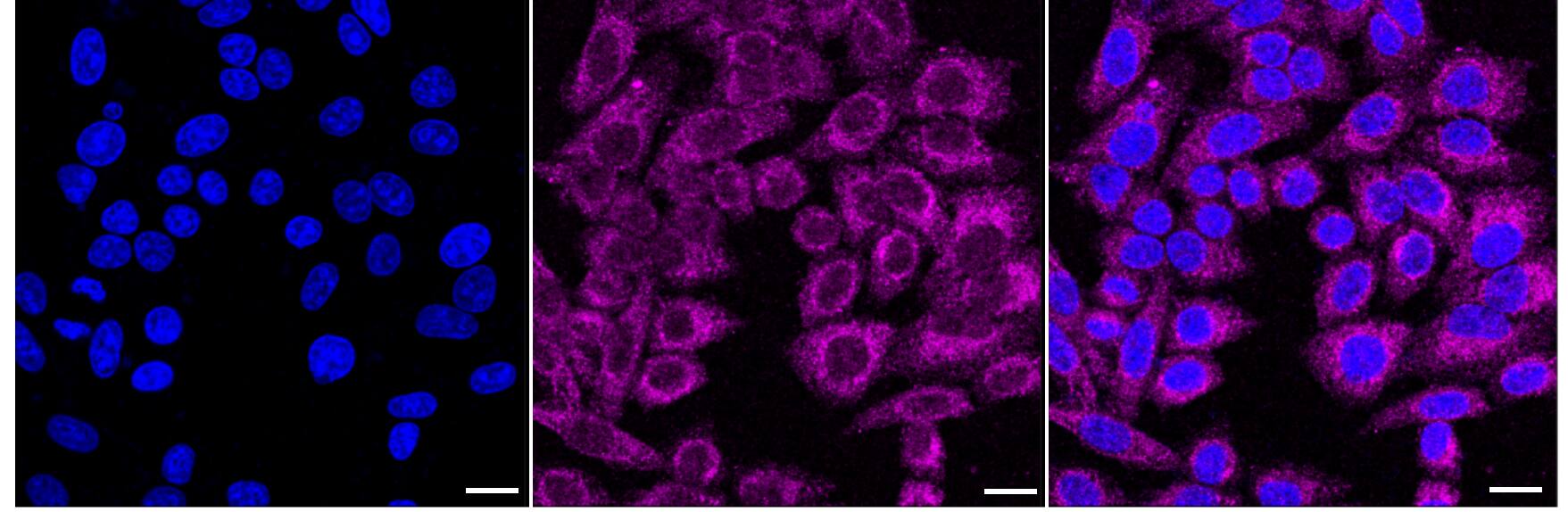 ULK1 Antibody (24GB2195)