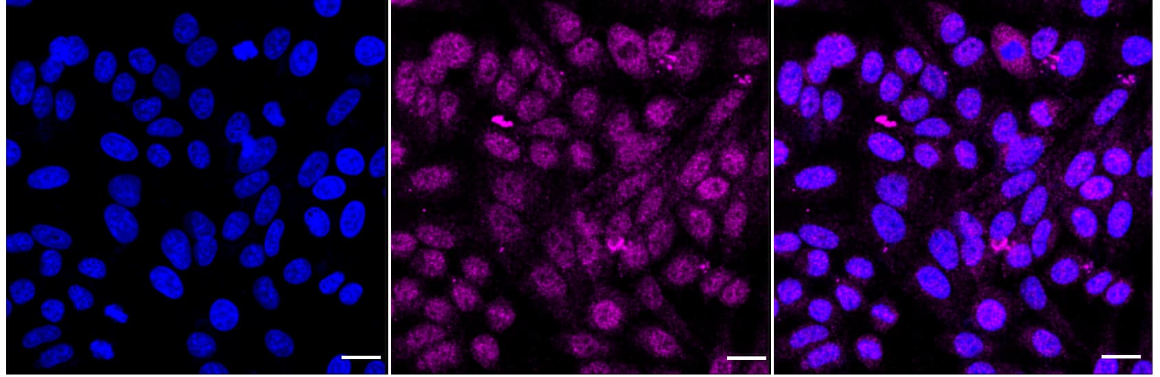 TRPM8 Antibody (24GB2225)