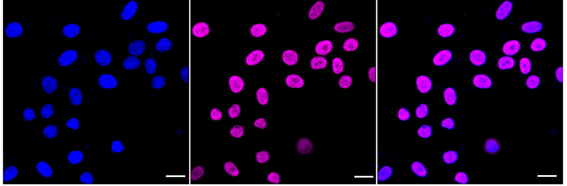 EPHX2 Antibody (24GB3070)