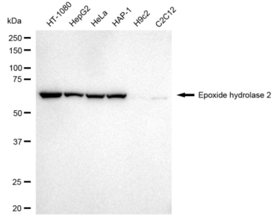 EPHX2 Antibody (24GB3070)