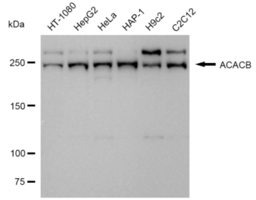 Acetyl Coenzyme A Carboxylase Beta Antibody (24GB3230)
