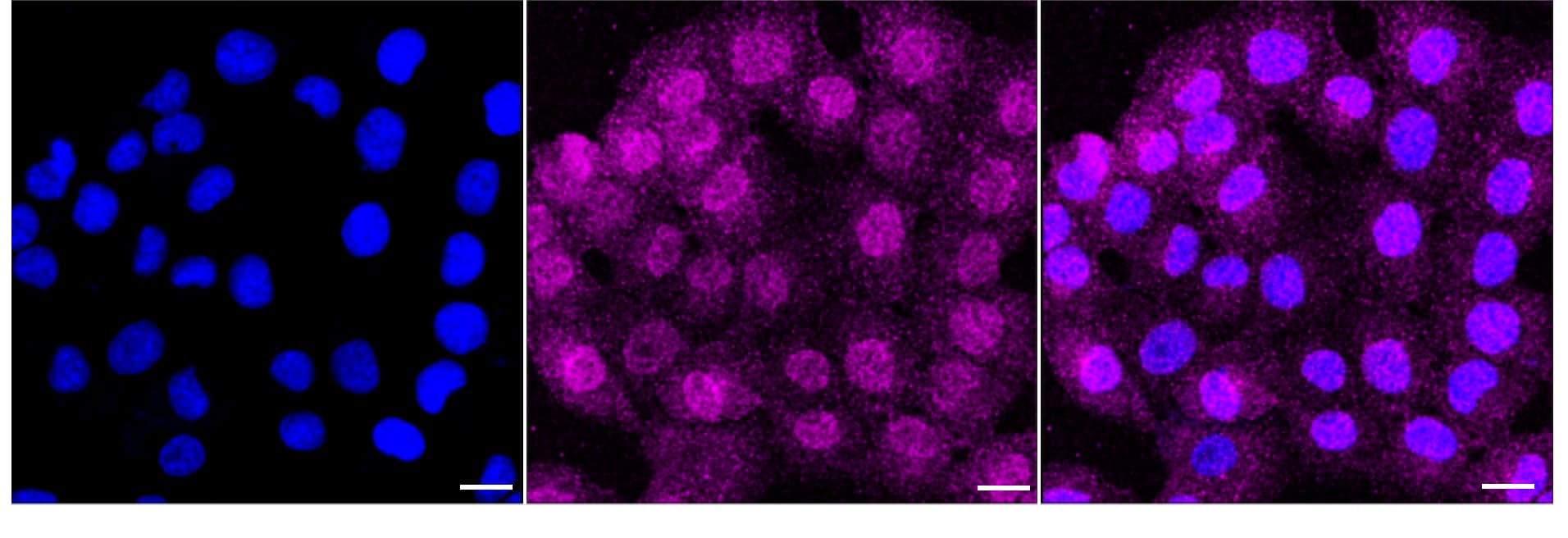Dysferlin Antibody (24GB3235)