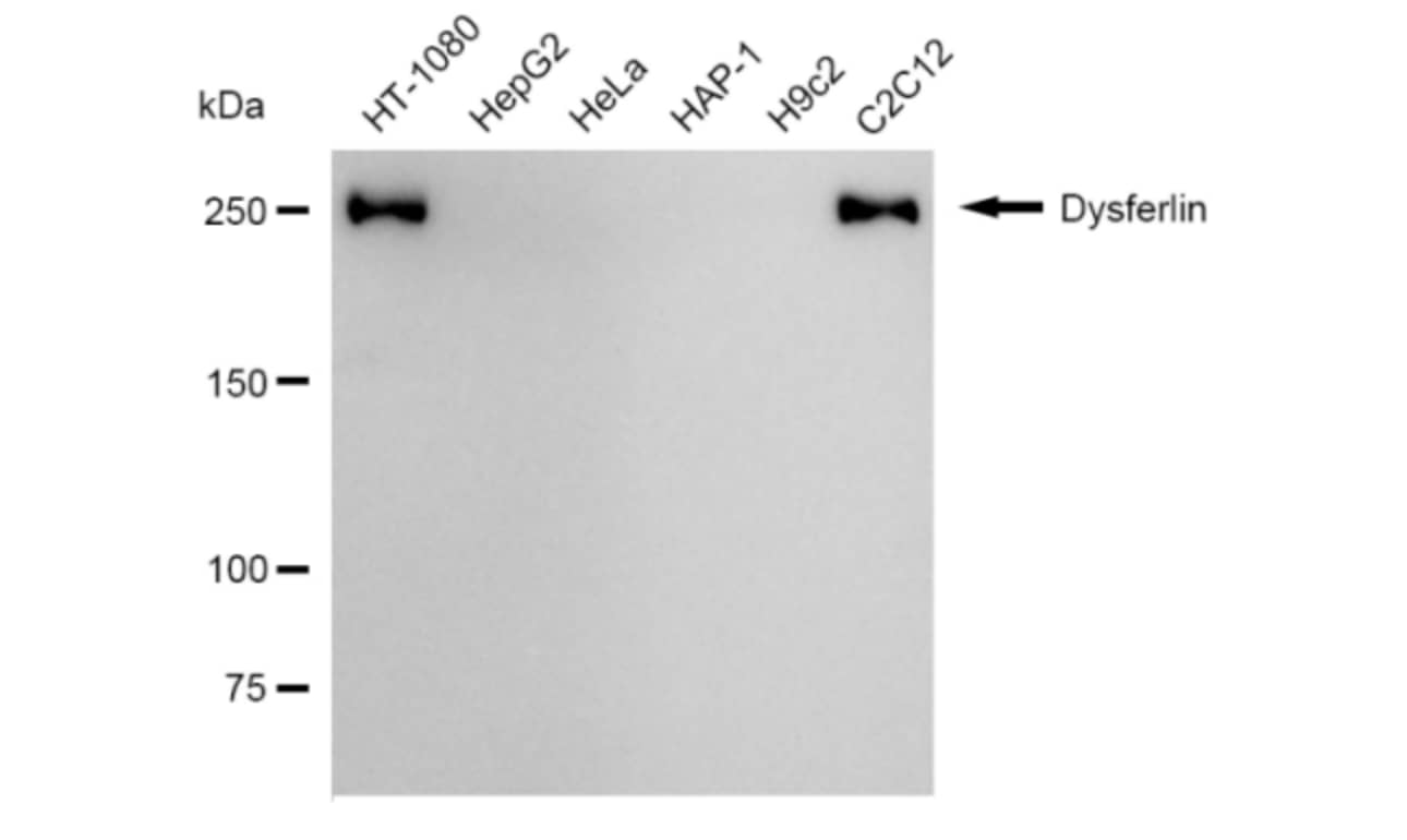 Dysferlin Antibody (24GB3235)