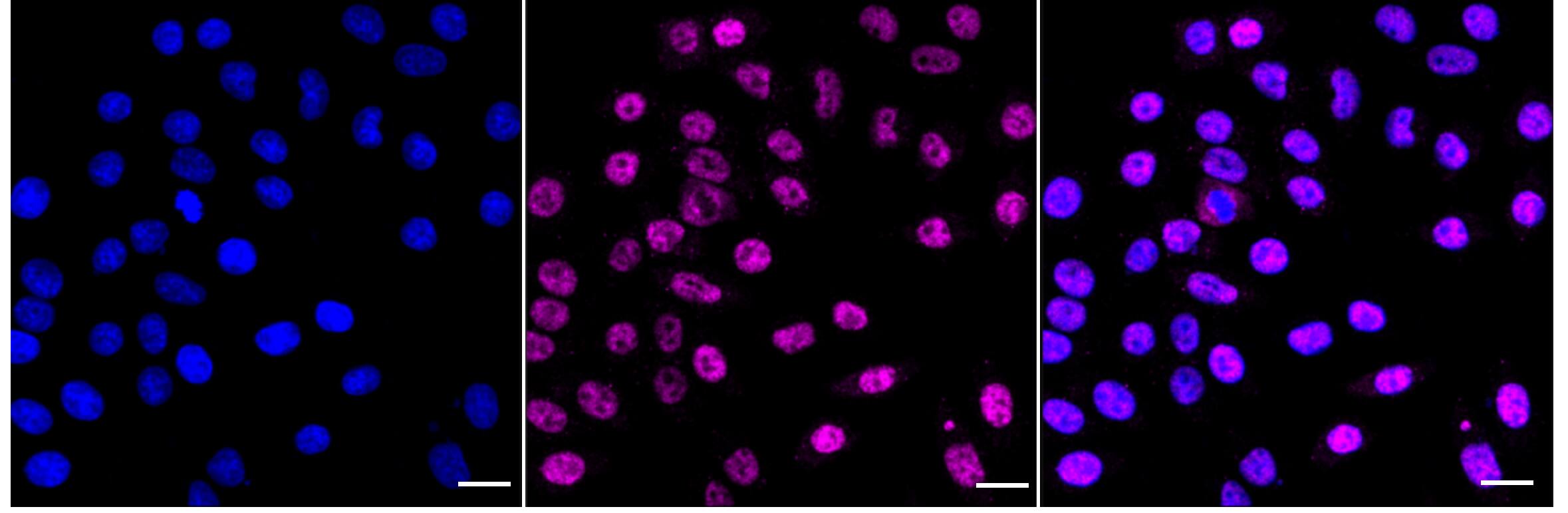 ADAR Antibody (24GB3705)