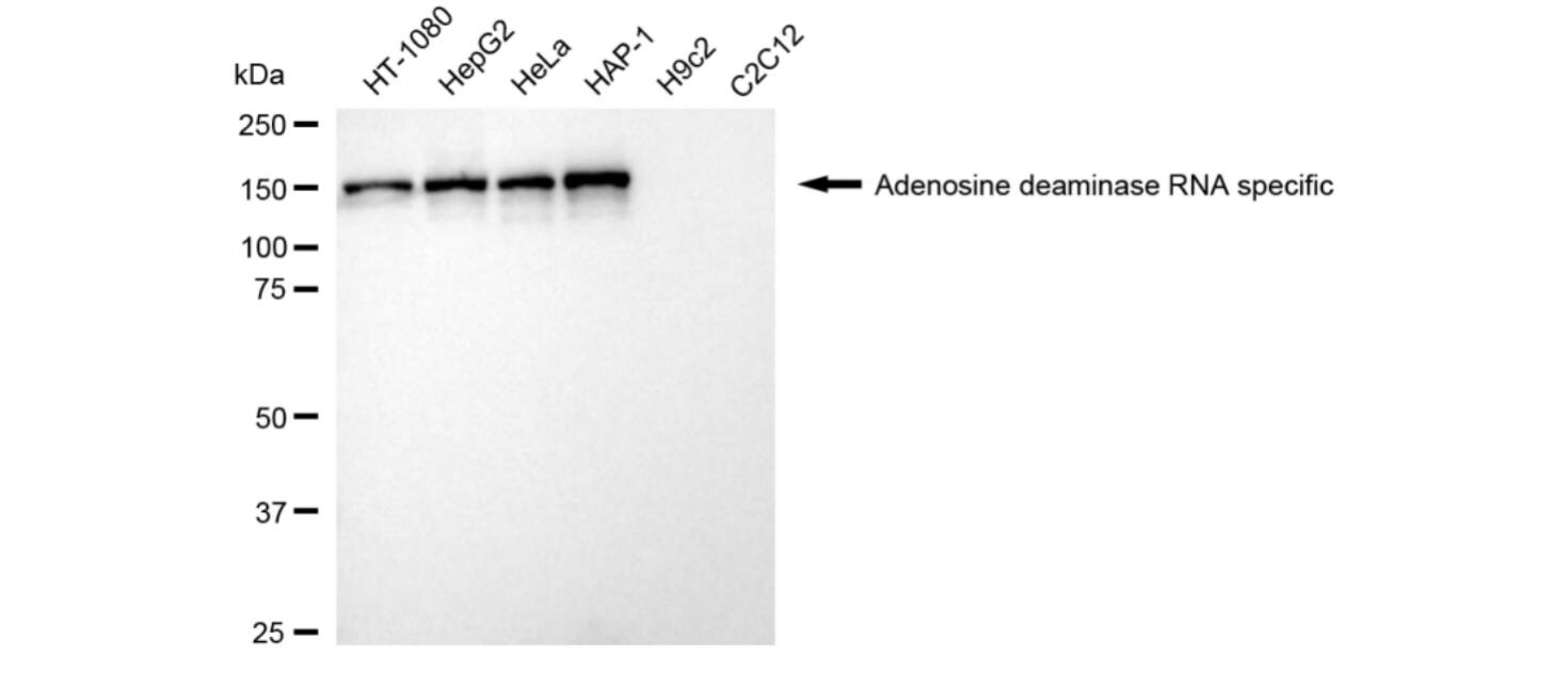 ADAR Antibody (24GB3705)