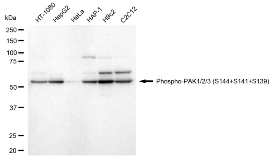 PAK1/2/3 [p Ser154] Antibody (24GB3960)