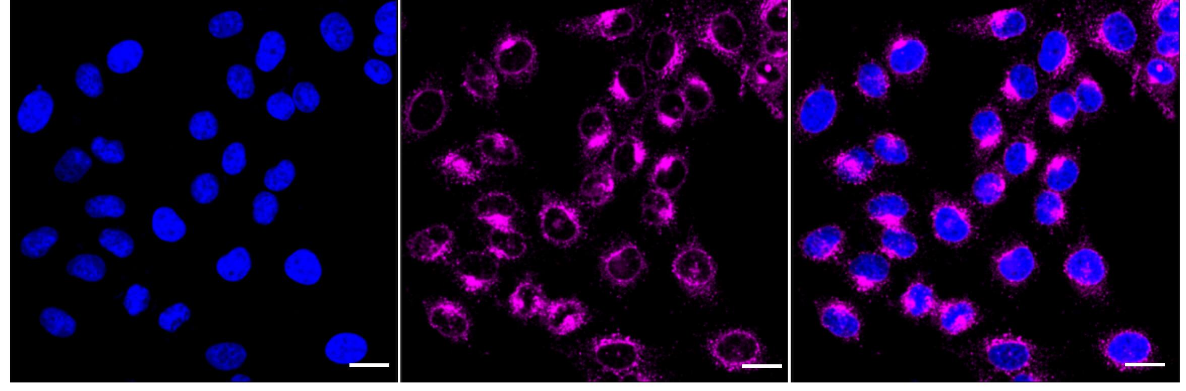 IFITM3/Fragilis Antibody (24GB5155)